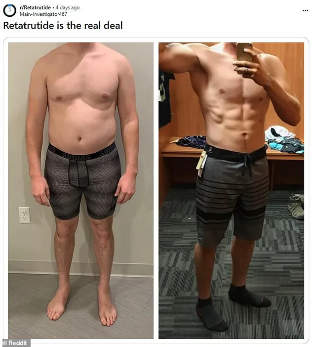 New Weight Loss Drug Shows Promising Results in Early Trials, Sparks Black Market Concerns