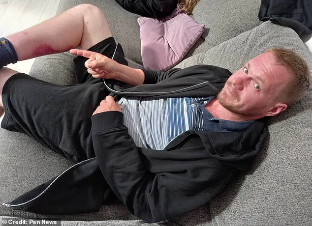 Britain's Most Dangerous Spider Sparks Health Crisis and Community Concerns After Devastating Bite Leaves Worker Hospitalized