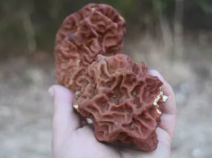 Groundbreaking Blood Test Predicts ALS a Decade Ahead of Symptoms, Johns Hopkins Reveals