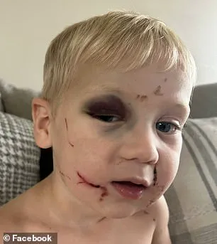 Daycare Worker Arrested in Child Abuse Case Amid Allegations of Cover-Up, Raising Concerns for Community Safety