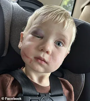 Daycare Worker Arrested in Child Abuse Case Amid Allegations of Cover-Up, Raising Concerns for Community Safety