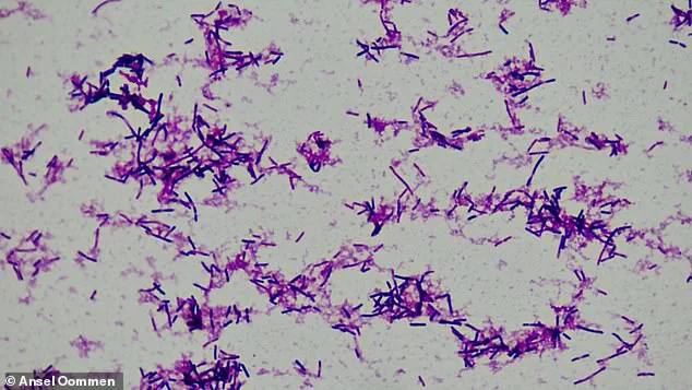 Study Reveals Link Between Gut Bacterium Clostridium innocuum and Increased Risk of Preterm Births