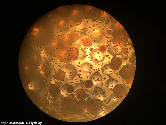 Expanded Recall of DermaRite Soaps Raises Alarms Over Burkholderia cepacia Risk to Immunocompromised Individuals, Warn Health Experts