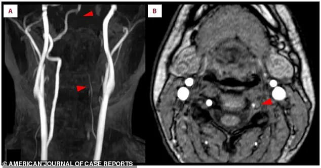 Health Risks of High-Impact Fitness Games Spark Debate on Regulatory Oversight