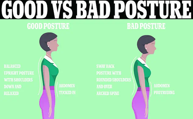 Surge in Thoracic Outlet Syndrome Among Young Adults Tied to Proliferation of Desk-Based Jobs