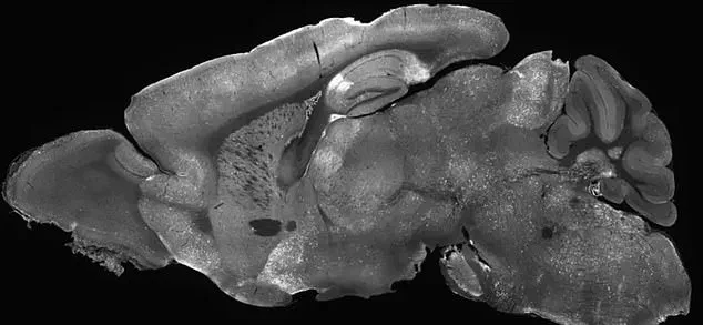 Breakthrough in Brain Disorder Research: New Therapy Offers Hope for Autism and Epilepsy Patients