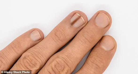 Don't Ignore the Warning Signs: Your Body's 'Whispers' May Signal Serious Health Risks, Say Experts