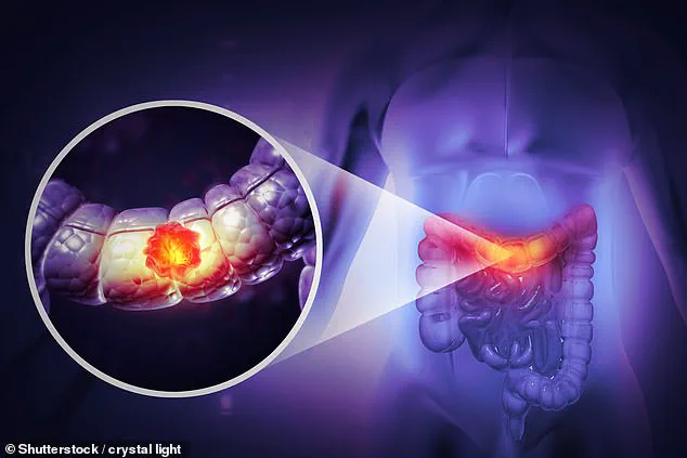 Dr. Hilary Jones Reveals Sweetcorn Trick to Detect Colon Cancer Risk