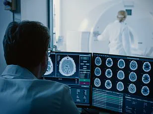 Health Experts Highlight Sundowning as Overlooked Dementia Symptom, Urge Caregiver Vigilance