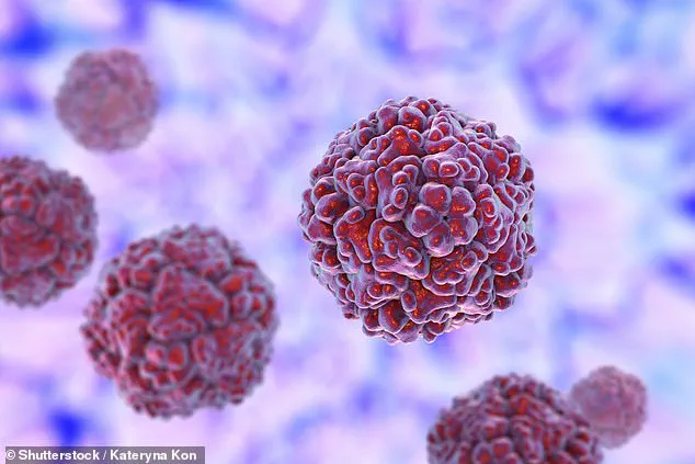 Unprecedented Surge in HFMD Sparks Urgent Warnings from Health Officials Across U.S. States