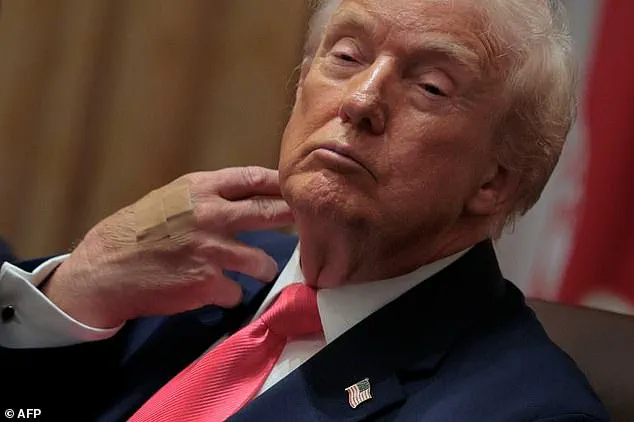 Health Scrutiny Intensifies for President Trump as Dietary Choices and Aging Spark Debate