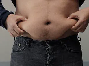 Climate Change and the Rising Migraine Crisis: A Public Health Emergency in the UK