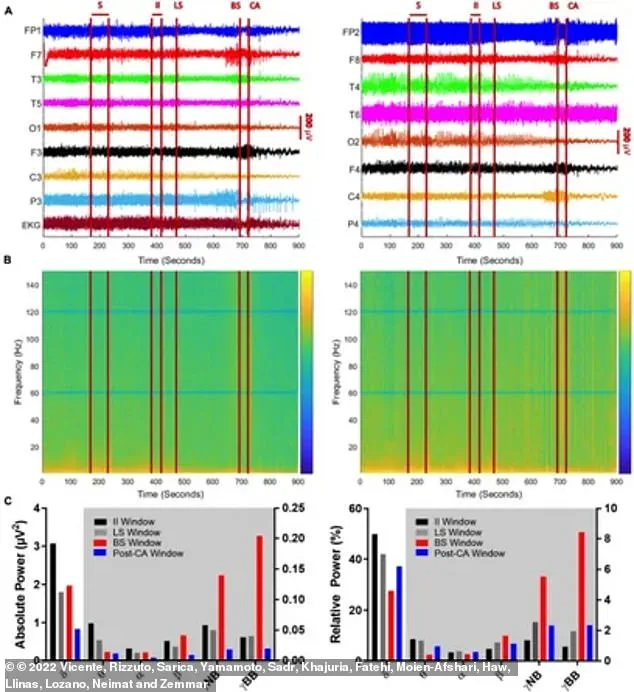 Groundbreaking Discovery Challenges Beliefs About Death and the Final Moments of the Brain
