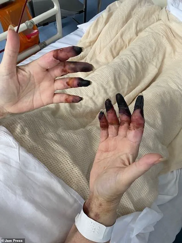 A Missed Diagnosis with Deadly Consequences: The Hidden Risks in Healthcare