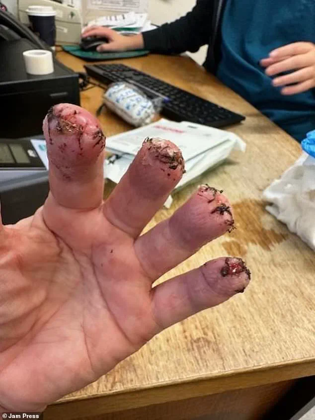 A Missed Diagnosis with Deadly Consequences: The Hidden Risks in Healthcare