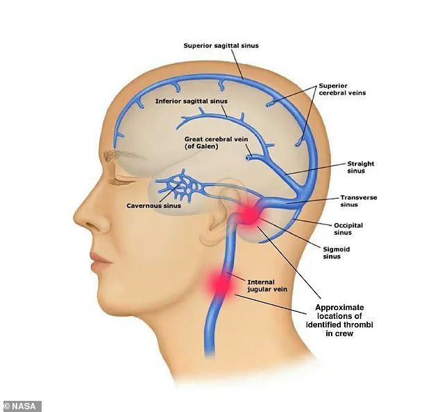 NASA's ISS Evacuation Sparks Global Debate on Space Travel Risks and Regulatory Gaps