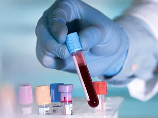 Study Reveals Stark Gender Disparity in Advanced Multiple Myeloma Outcomes