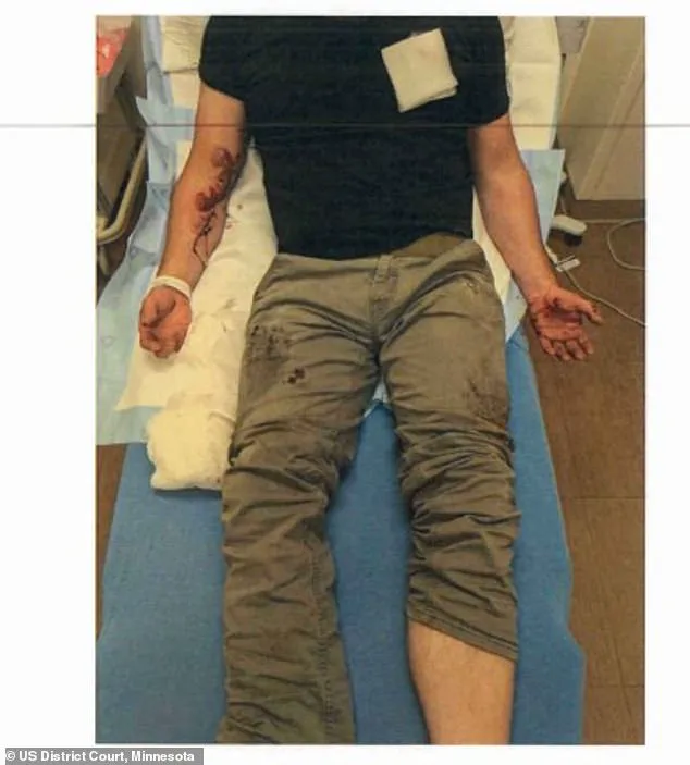 Controversial Encounter Between ICE Agent and Protester Sparks Controversy Over Injuries and Conflicting Narratives