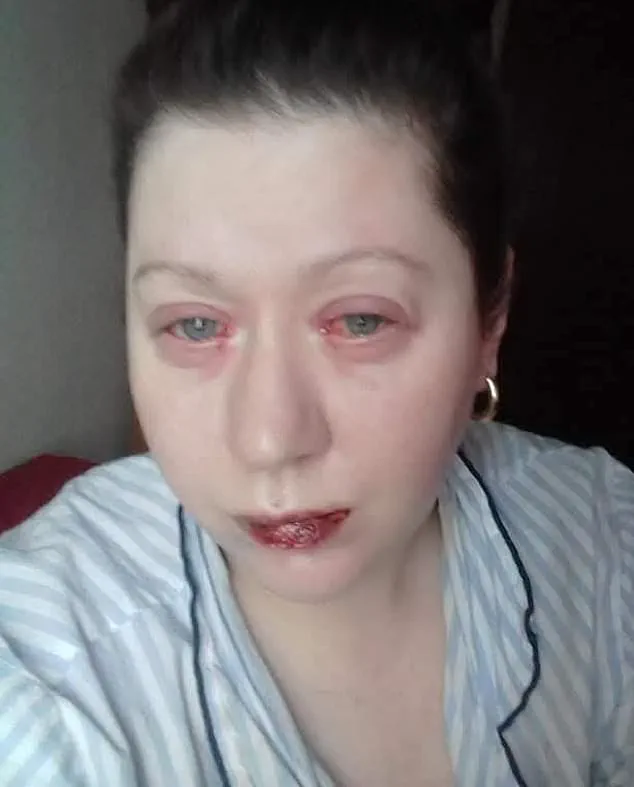 Urgent Health Alert: Benylin Use Triggers Harrowing Medical Emergency – What You Need to Know Now