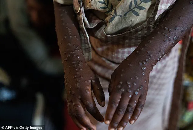 Urgent Alert: Emerging Viral Threats in 2026 – Experts Warn of Climate-Driven Risks and Global Mobility Challenges