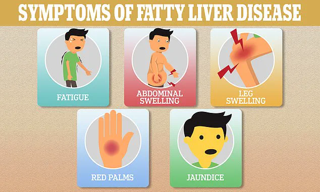 Fatty Liver Disease: 1.5 Billion Unaware of Silent Condition Linked to Obesity and Modern Lifestyles