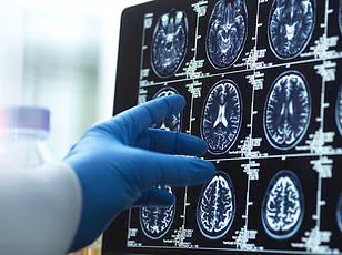 Rising Dementia Rates Prompt Government Action on Lifestyle Regulations