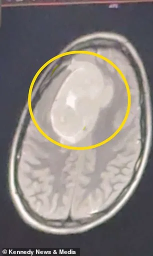 Defying Dismissal: A Student's Relentless Fight Against Misdiagnosed Migraines