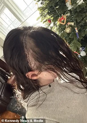 Defying Dismissal: A Student's Relentless Fight Against Misdiagnosed Migraines