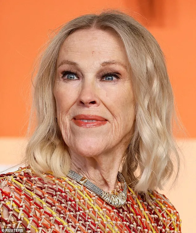 Experts Warn of Missed Pulmonary Embolism Symptoms After Catherine O'Hara's Death