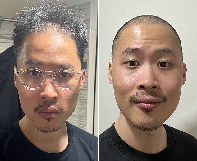 From Insecurity to Self-Acceptance: How r/bald Became a Supportive Community for Balding Men