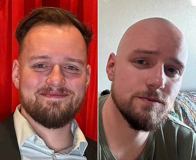 From Insecurity to Self-Acceptance: How r/bald Became a Supportive Community for Balding Men