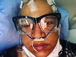 Study Reveals Link Between Long Covid and Increased Dementia Risk