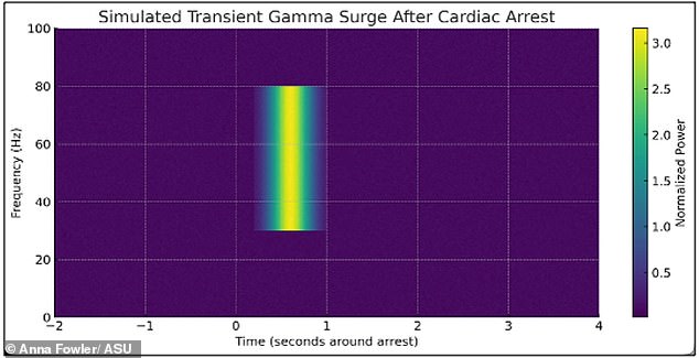 Study Suggests Consciousness May Persist Beyond Brain and Heart Stoppage, Challenging Traditional Death Definitions