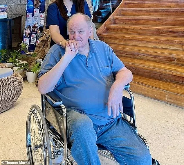 Thomas Markle Sr Fitted for Prosthetic Leg After Life-Saving Surgery
