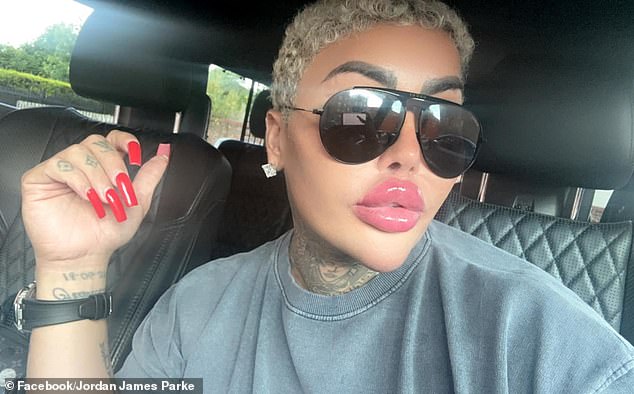 Tragic Death of 'The Lip King' Sparks Arrests and Industry Scrutiny