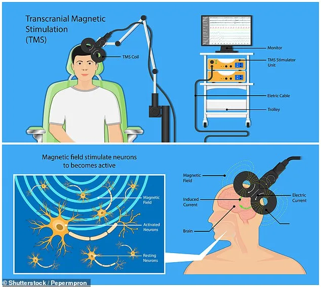 Revolutionary Five-Day TMS Therapy Offers Rapid Relief for Treatment-Resistant Depression