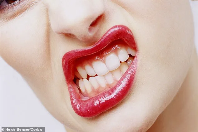 Silent Epidemic: Teeth Grinding Overlooked by Doctors, Leading to Lasting Damage