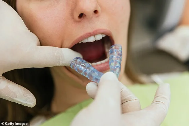 Silent Epidemic: Teeth Grinding Overlooked by Doctors, Leading to Lasting Damage