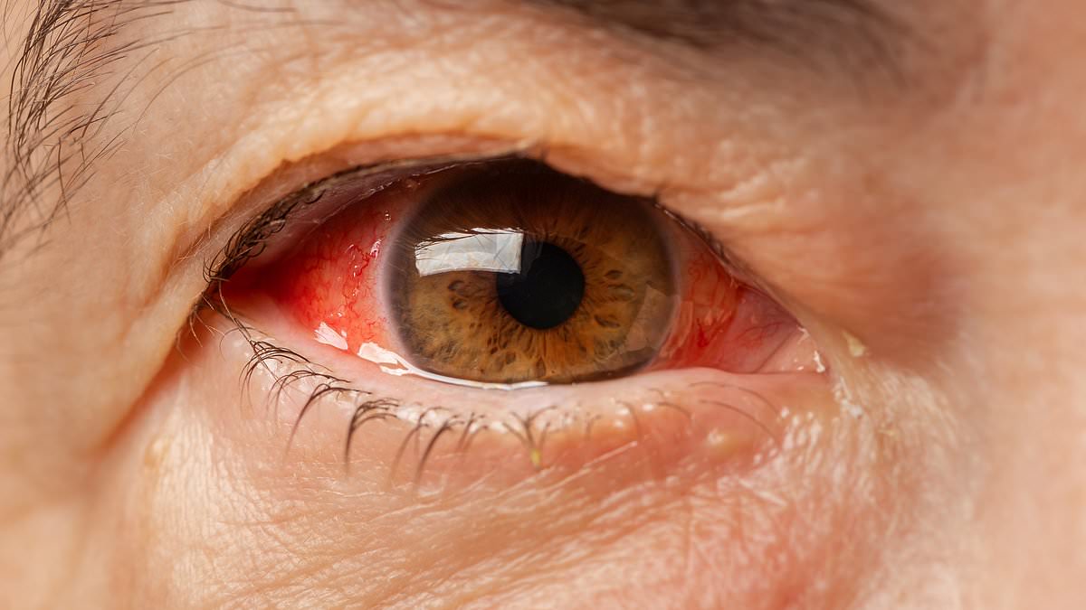 Uganda Cave Footage Exposes Marburg Virus's Deadly Animal Network