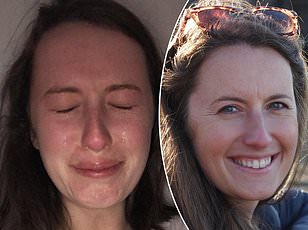 Double Vision: A Critical Warning Sign of Stroke That Cannot Be Ignored