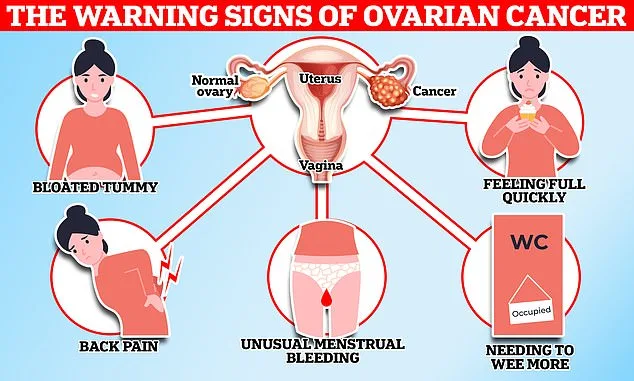 Urgent Call to Recognize Ovarian Cancer Symptoms: Early Detection Could Save Lives, Warns Robin Cancer Trust