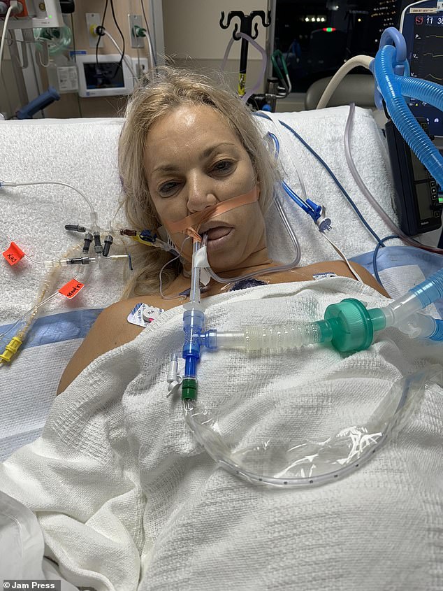 Five Years of Pain: How Ruptured Breast Implants Led to a Medical Crisis for Carol Paredes