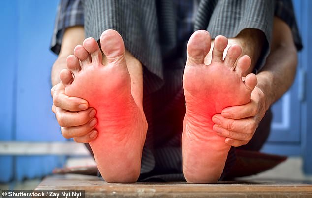 Burning Feet: A Warning Sign of Diabetic Neuropathy and Amputation Risk