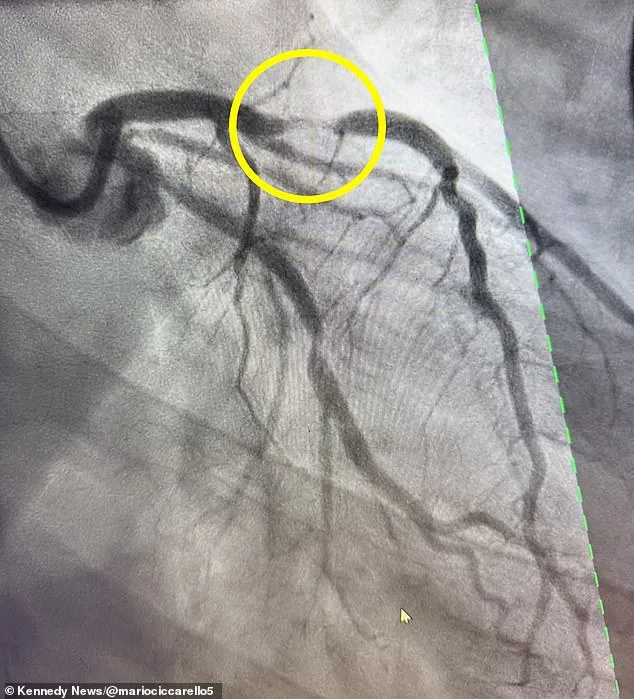 When Fitness Meets Fate: A Runner's Unexpected Medical Crisis