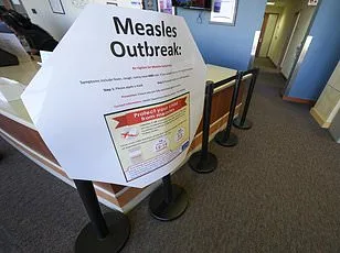 Measles Resurgence Sparks Fears of Deadly Complication: SSPE Linked to U.S. Outbreak
