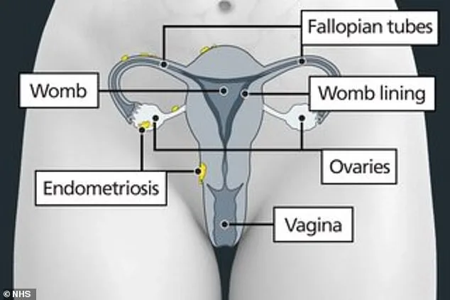 Breakthrough in Endometriosis Detection: New Five-Minute Test Aims to Revolutionize Early Diagnosis