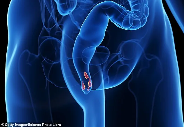 From Dread to Discovery: How a Simple Remedy Transformed a Man's Battle with Hemorrhoids