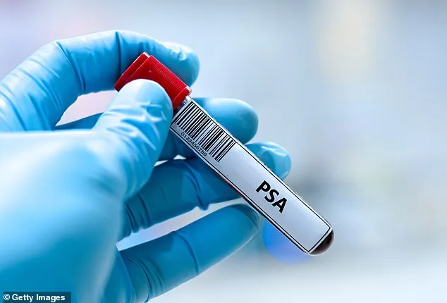 Study Suggests PSA Blood Tests for Men Match Mammograms in Cancer Detection, Sparking Debate