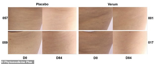 Tiny Pill, Big Impact: How a $1.25 Supplement is Revolutionizing the Fight Against Cellulite