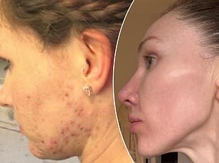 Collagen Supplements Show Credible Benefits for Skin and Joint Health, Study Reveals